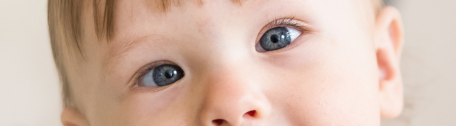 Causes of Strabismus?