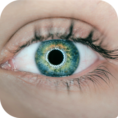 İlasik / Refraktif Cerrahi